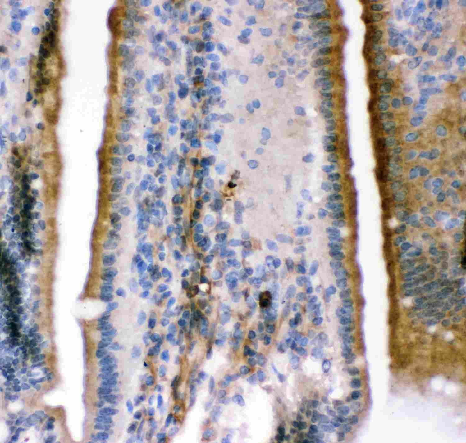 2 - Anti-KCNMA1 Picoband Antibody ABO11918