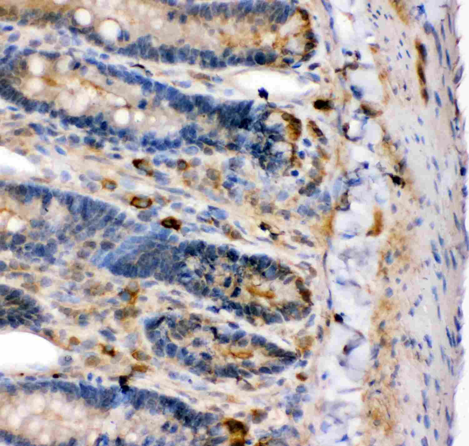 2 - Anti-KCNMA1 Picoband Antibody ABO11918