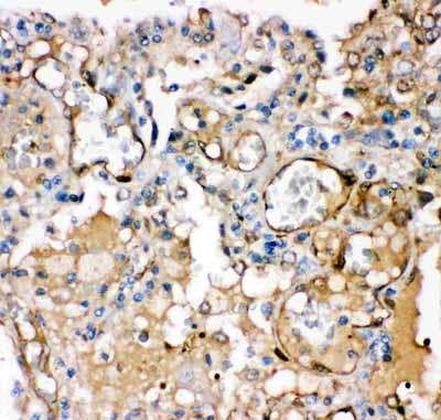 2 - Anti-KCNMA1 Picoband Antibody ABO11918