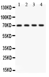 1 - Anti-KCNMA1 Picoband Antibody ABO11918