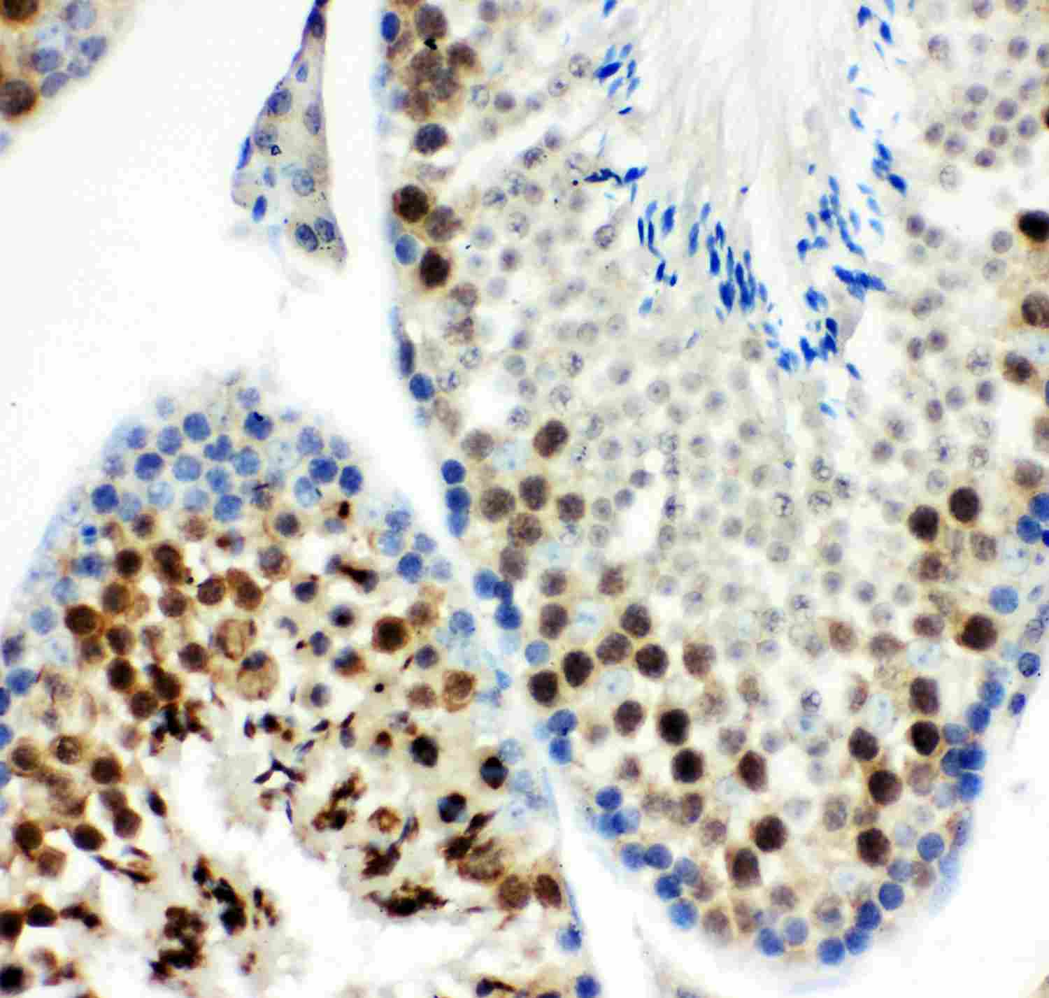 2 - Anti-MCAK Picoband Antibody ABO11921
