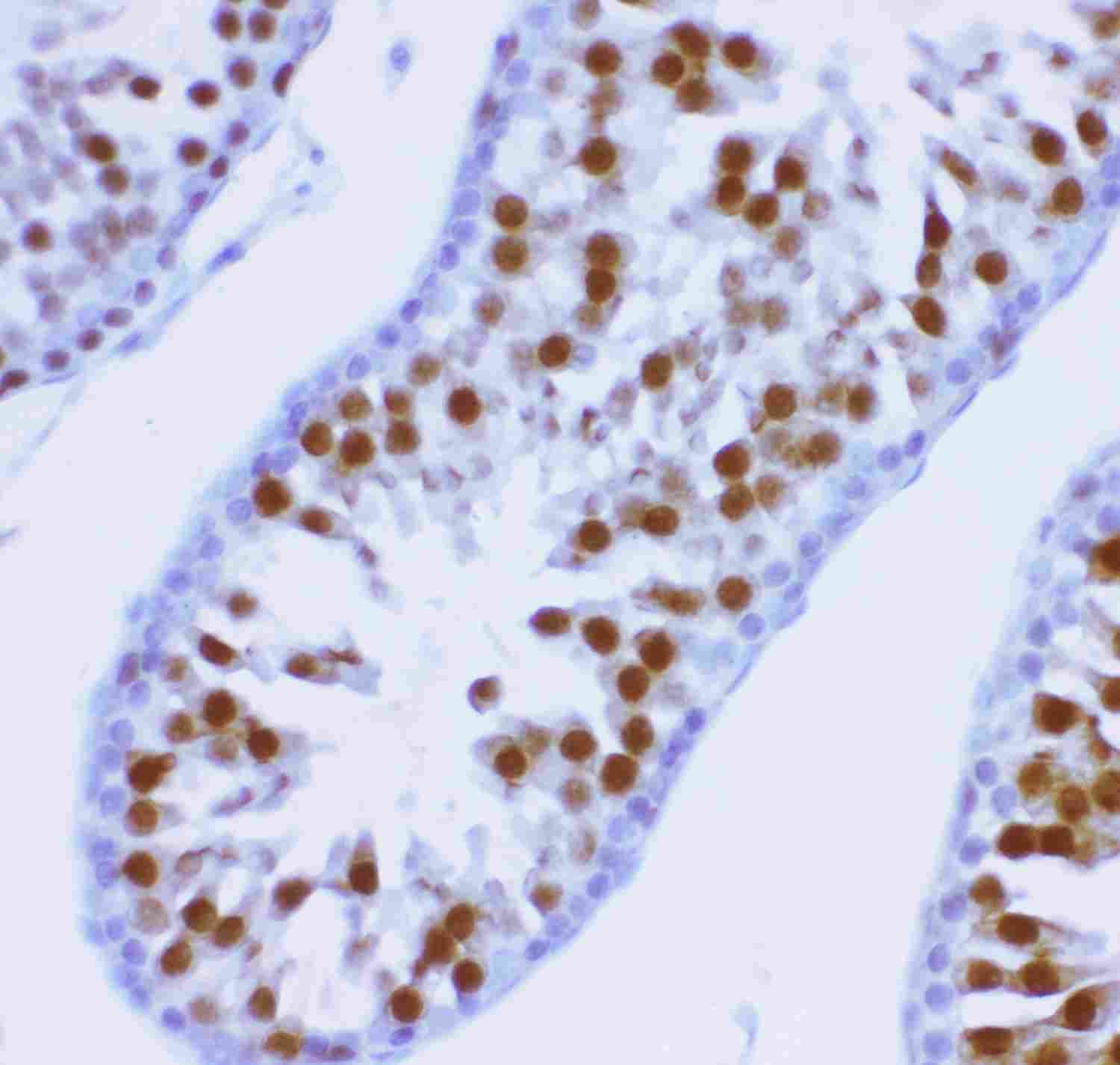 2 - Anti-MCAK Picoband Antibody ABO11921