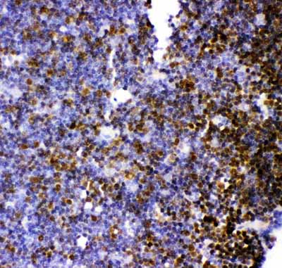 2 - Anti-MCAK Picoband Antibody ABO11921