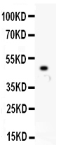 1 - Anti-MCAK Picoband Antibody ABO11921