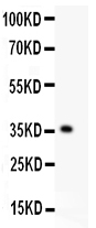 1 - Anti-KLF6 Picoband Antibody ABO11922