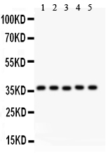 1 - Anti-KLF6 Picoband Antibody ABO11922