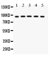 1 - Anti-NR3C1 Picoband Antibody ABO11923