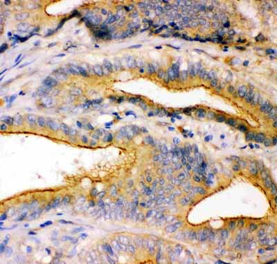 2 - Anti-TJP1 Picoband Antibody ABO11925