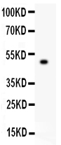 1 - Anti-TJP1 Picoband Antibody ABO11925