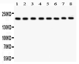 1 - Anti-TJP1 Picoband Antibody ABO11925