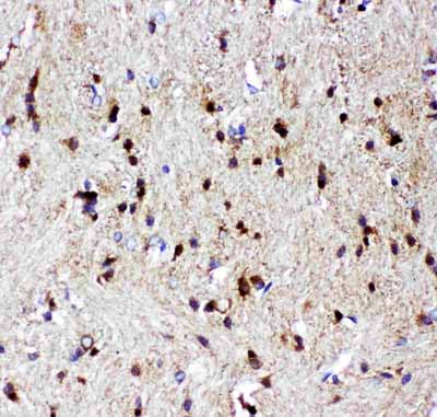 2 - Anti-p73 Picoband Antibody ABO11926