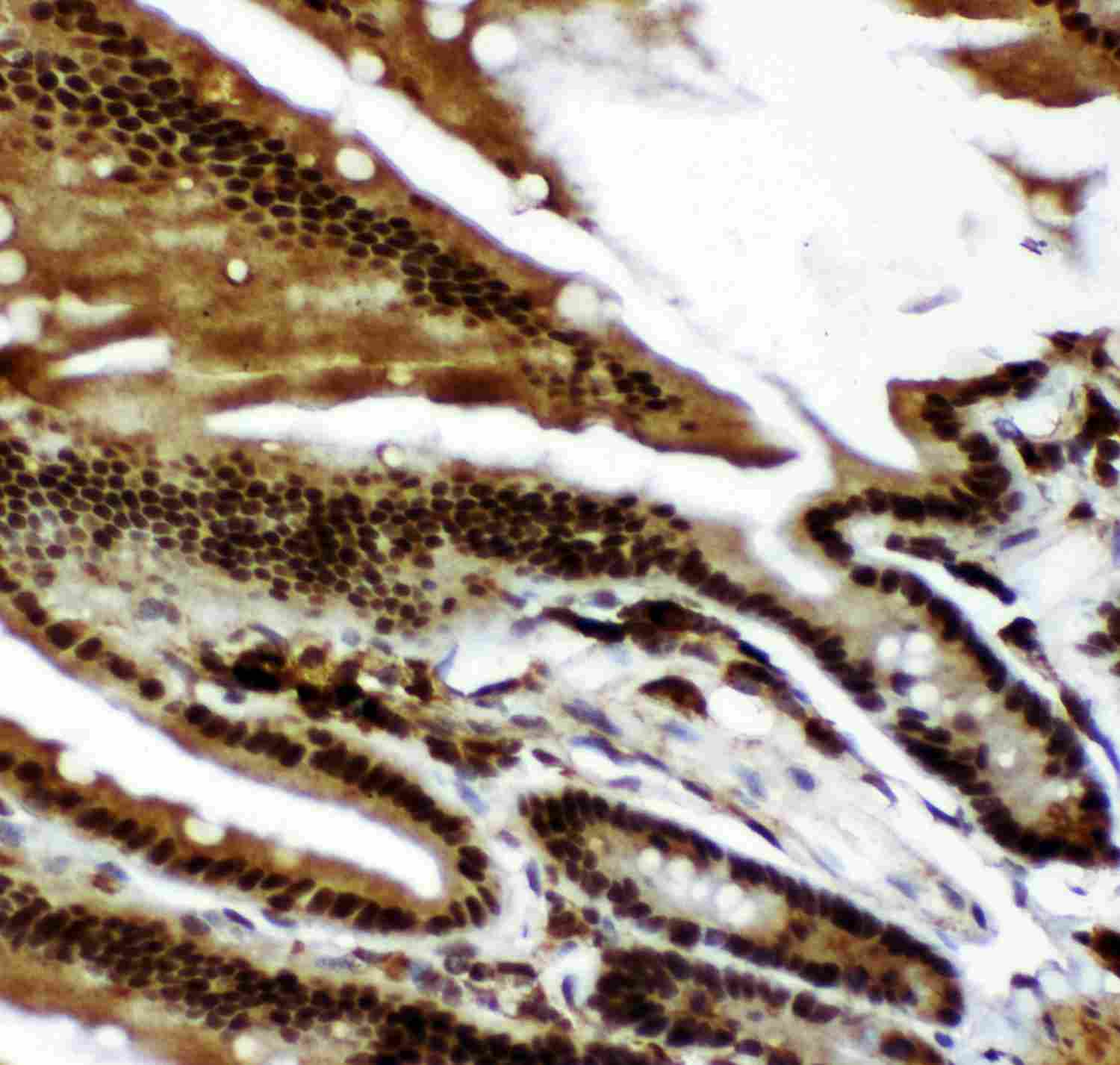 2 - Anti-p73 Picoband Antibody ABO11926
