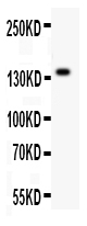 1 - Anti-ZEB2 Picoband Antibody ABO11927
