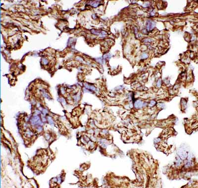 2 - Anti-Hsp27 Picoband Antibody ABO11928