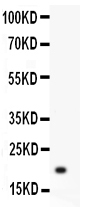 1 - Anti-Hsp27 Picoband Antibody ABO11928