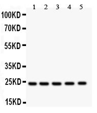 1 - Anti-Hsp27 Picoband Antibody ABO11928