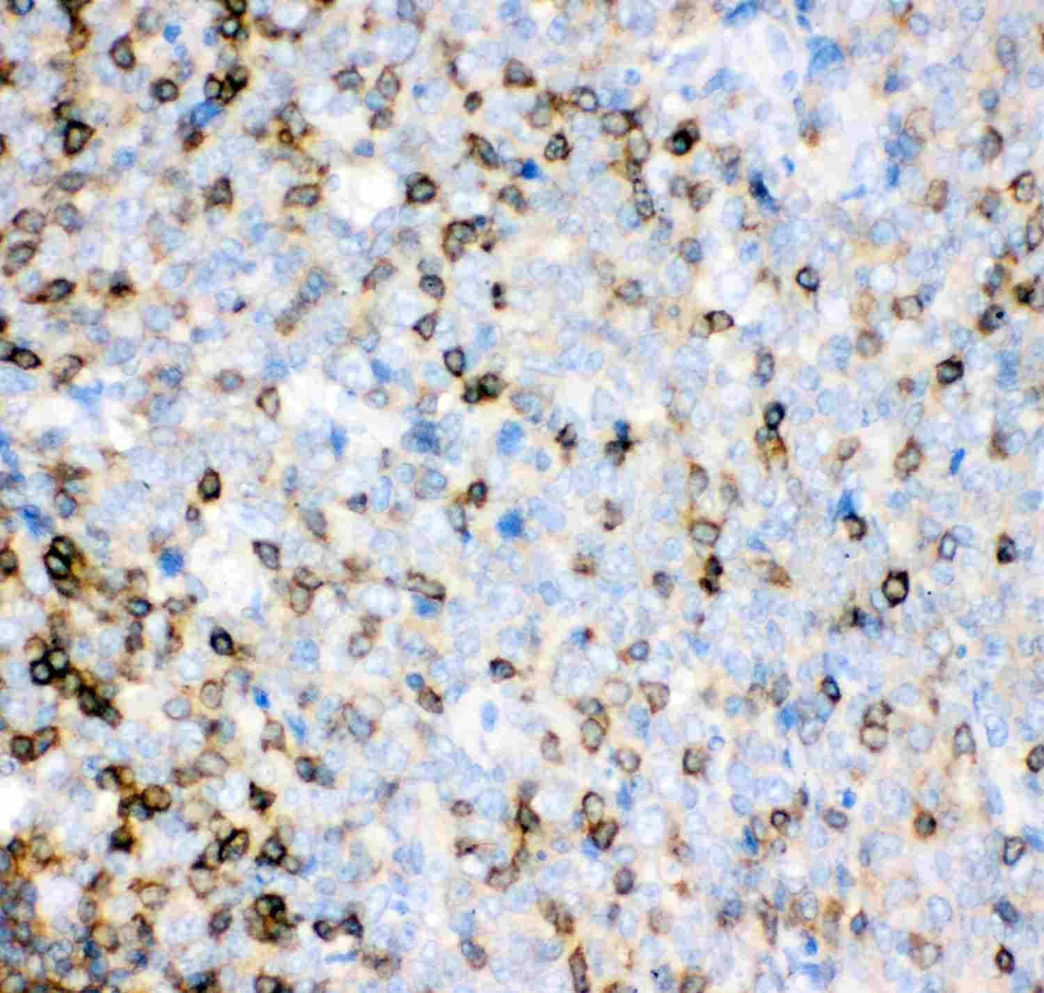 2 - Anti-IL-16 Antibody ABO11929