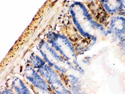 2 - Anti-Galectin-1 Antibody ABO11931