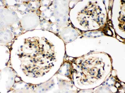 2 - Anti-Galectin-1 Antibody ABO11931