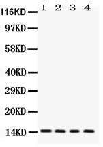 1 - Anti-Galectin-1 Antibody ABO11931