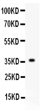 1 - Anti-FGF1 Picoband Antibody ABO11932