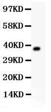 1 - Anti-Fetuin A Picoband Antibody ABO11933