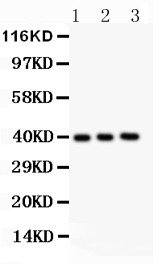 1 - Anti-Fetuin A Picoband Antibody ABO11933