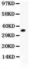 1 - Anti-RACK1 Picoband Antibody ABO11934