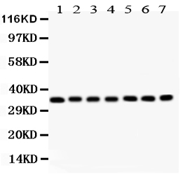 1 - Anti-RACK1 Picoband Antibody ABO11934
