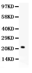 1 - Anti-IL-18 Antibody ABO11936