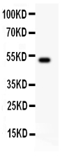 1 - Anti-IL-18 Antibody ABO11936