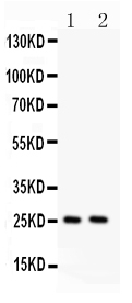 1 - Anti-TNF Alpha Picoband Antibody ABO11937