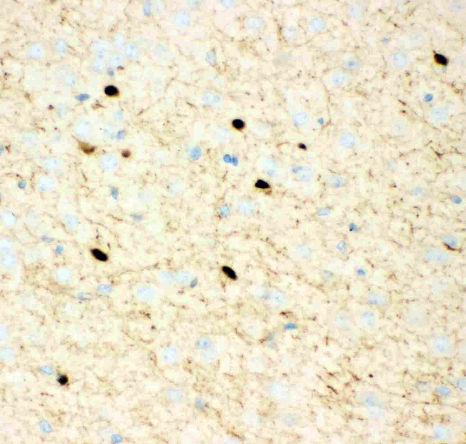 2 - Anti-Calretinin Picoband Antibody ABO11939