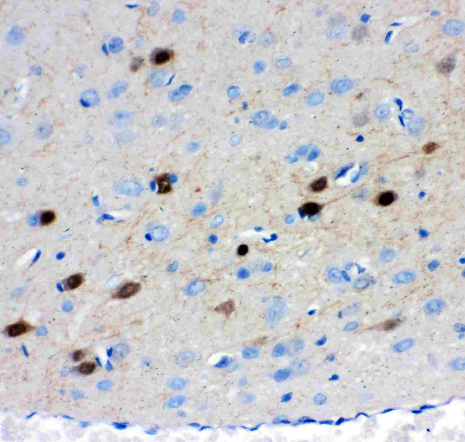 2 - Anti-Calretinin Picoband Antibody ABO11939