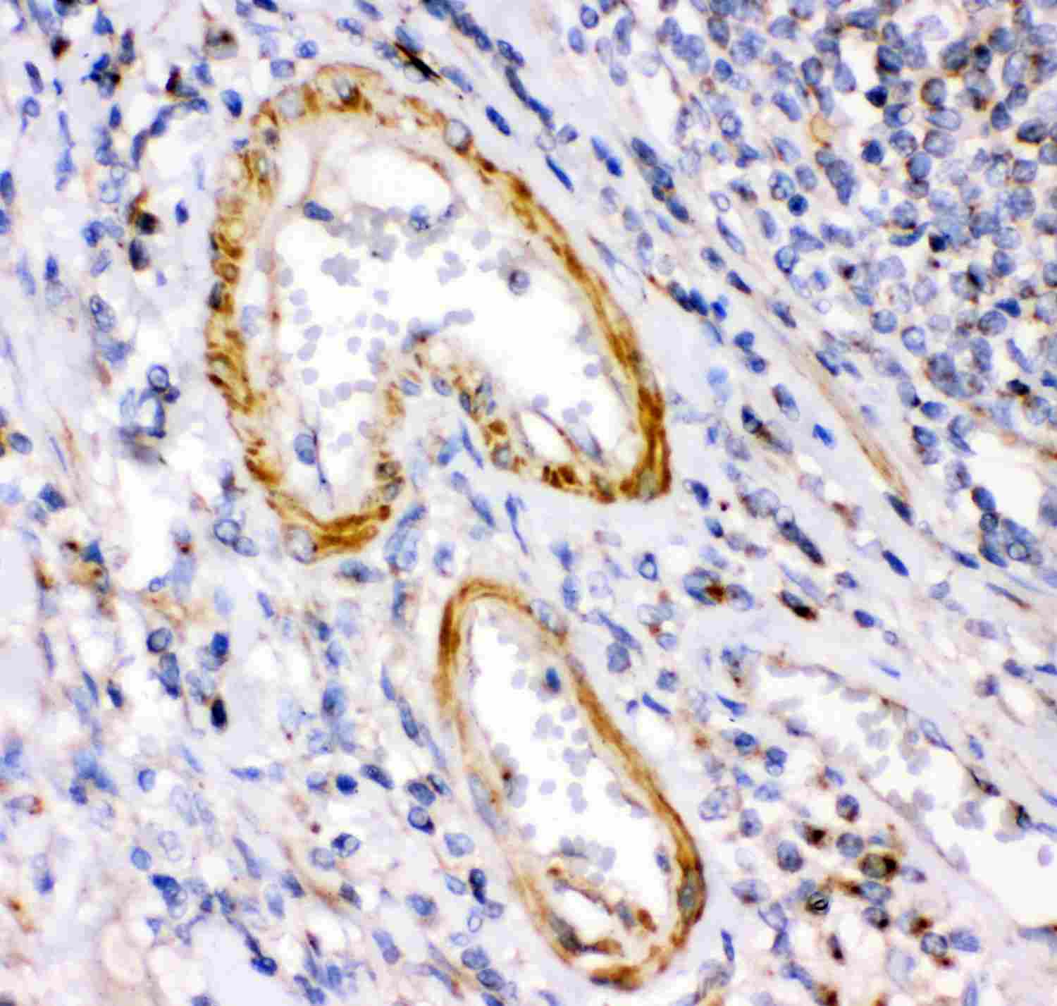 2 - Anti-Calretinin Picoband Antibody ABO11939