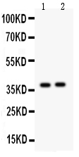 1 - Anti-Calretinin Picoband Antibody ABO11939