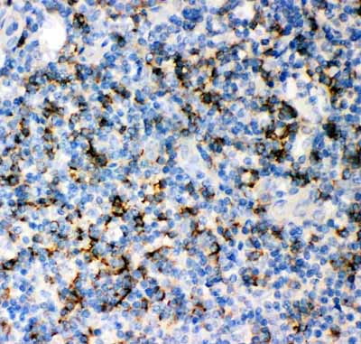 2 - Anti-CD8 Alpha Picoband Antibody ABO11940