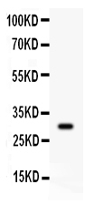1 - Anti-CD8 Alpha Picoband Antibody ABO11940