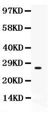 1 - Anti-CD63 Picoband Antibody ABO11941