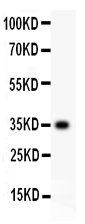 1 - Anti-CD63 Picoband Antibody ABO11941