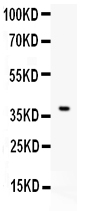1 - Anti-CD86/B7-2 Antibody ABO11942