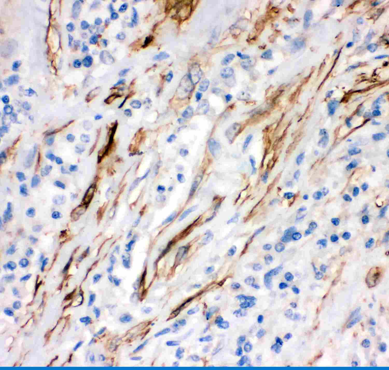2 - Anti-FAS Antibody ABO11943
