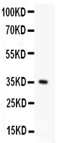 1 - Anti-FAS Antibody ABO11943