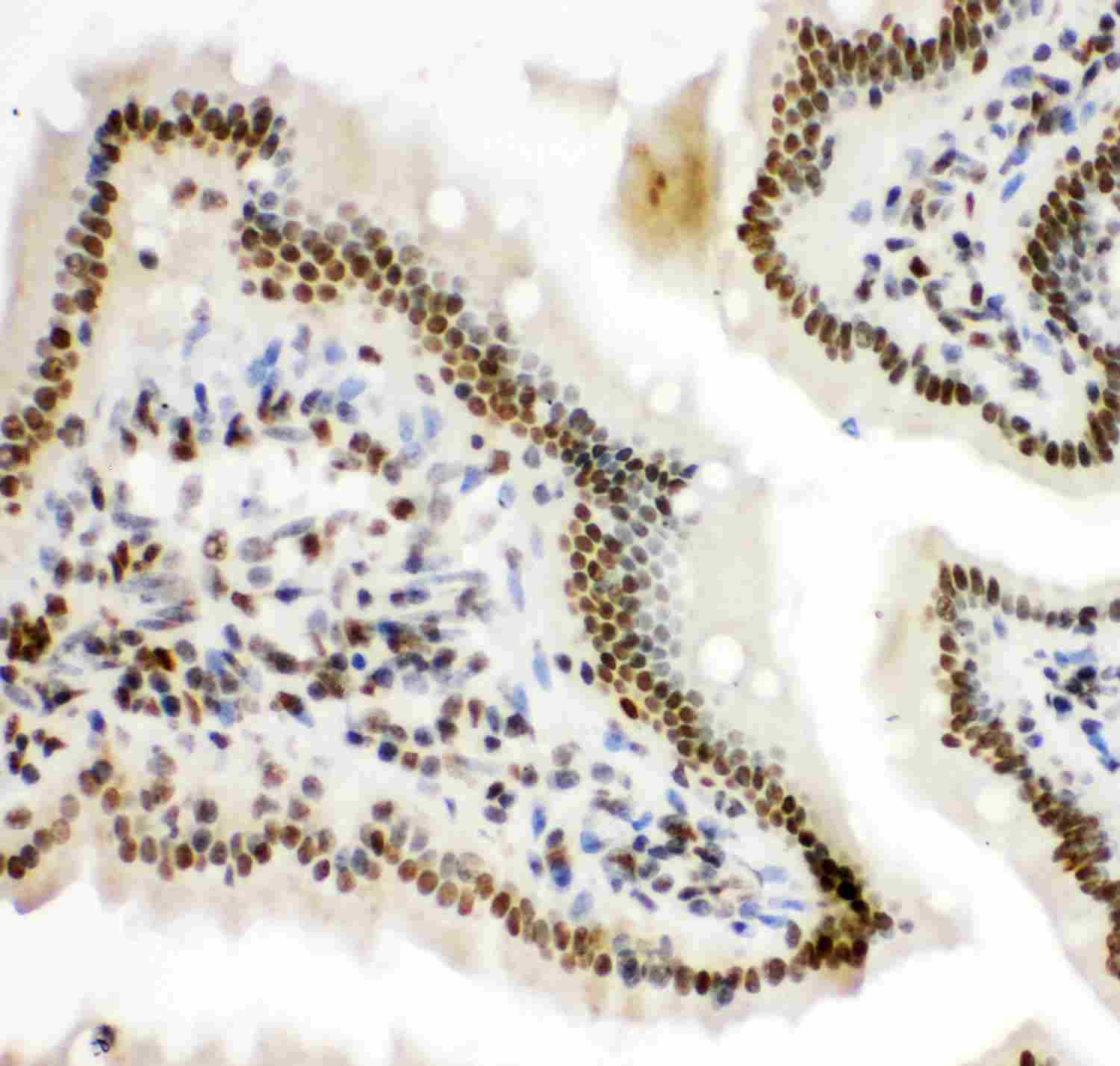 2 - Anti-HIF-1-Alpha Picoband Antibody ABO11944