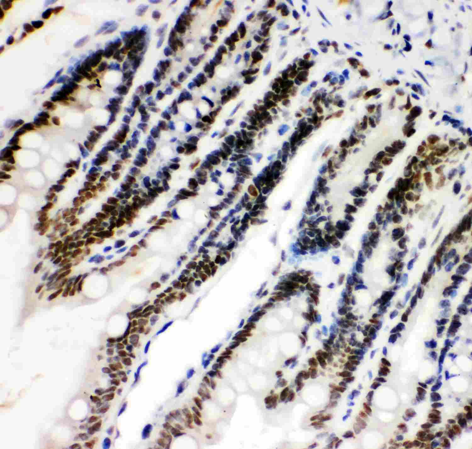 2 - Anti-HIF-1-Alpha Picoband Antibody ABO11944