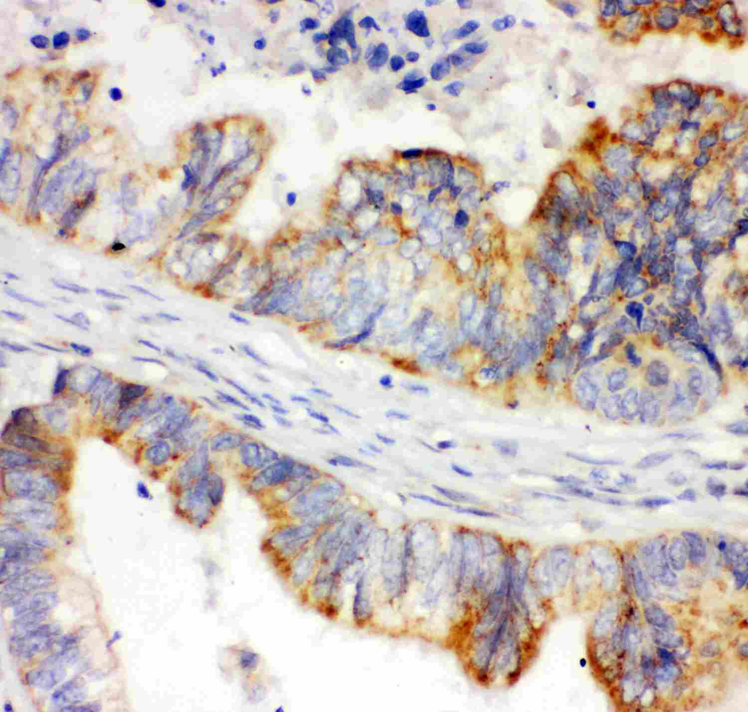 2 - Anti-HIF-1-Alpha Picoband Antibody ABO11944