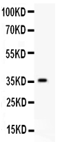 1 - Anti-HIF-1-Alpha Picoband Antibody ABO11944