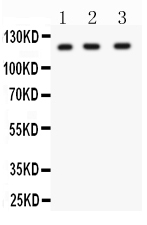 1 - Anti-HIF-1-Alpha Picoband Antibody ABO11944