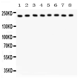 1 - Anti-Integrin Alpha 5 Picoband Antibody ABO11945