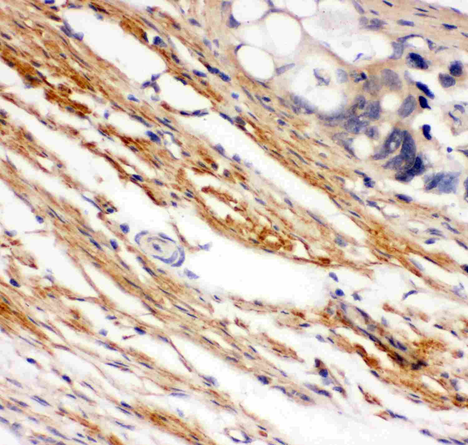 2 - Anti-KIT/SCFR Antibody ABO11949